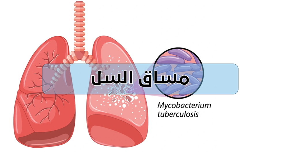 مساق السل